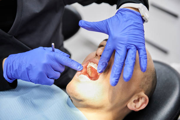 Best Emergency Tooth Extraction  in Daly City, CA